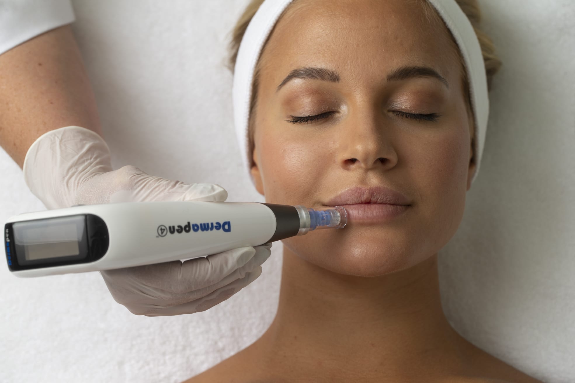 Microneedling med Dermapen hos Clinic Yvonne