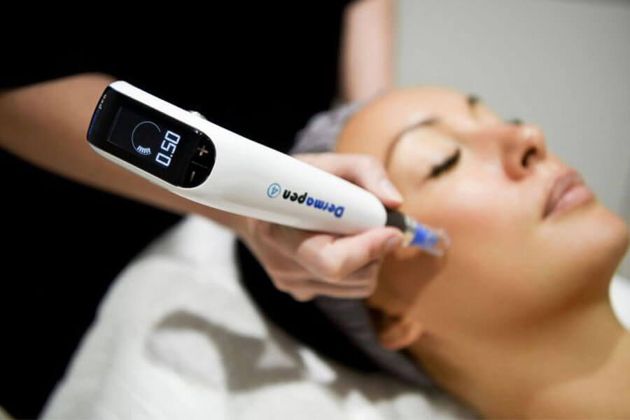 Microneedling-behandling i gang hos Clinic Yvonne