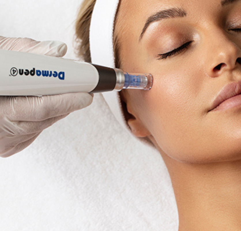 Dermapen-behandling av kinn hos Clinic Yvonne