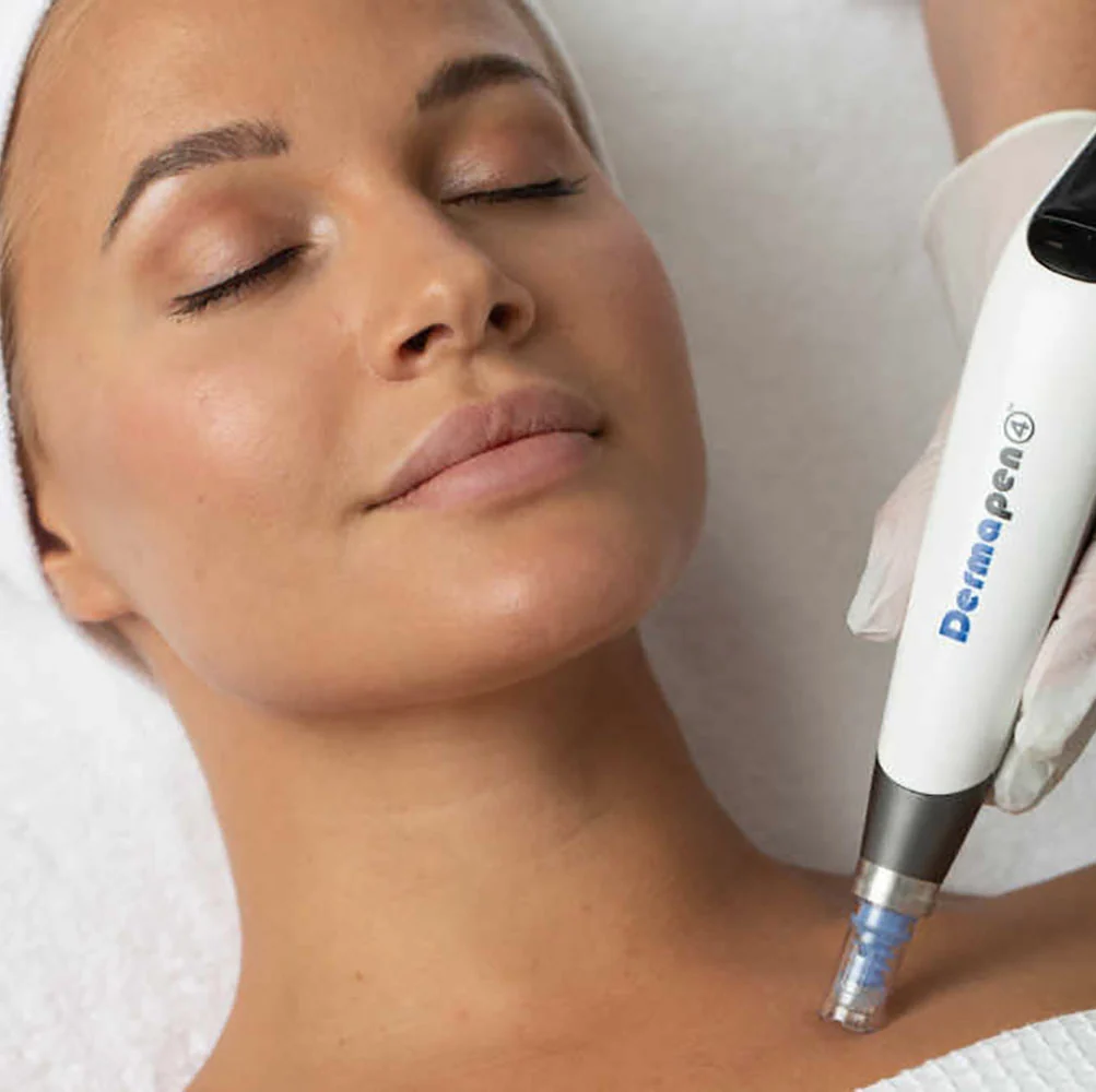 Hudfornyende Dermapen-behandling hos Clinic Yvonne
